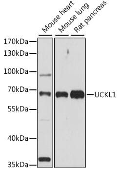Western blot analysis of extracts of various cell lines, using Anti-UCKL1 Antibody (A15851) at 1:1,000 dilution.
Secondary antibody: Goat Anti-Rabbit IgG (H+L) (HRP) (AS014) at 1:10,000 dilution.
Lysates / proteins: 25µg per lane.
Blocking buffer: 3% non-fat dry milk in TBST.
Detection: ECL Basic Kit (RM00020).
Exposure time: 90s.