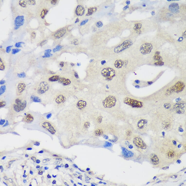 Immunohistochemistry - Anti-UCKL1 Antibody (A90729) - Antibodies.com