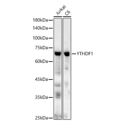Western Blot - Anti-YTHDF1 Antibody (A90730) - Antibodies.com