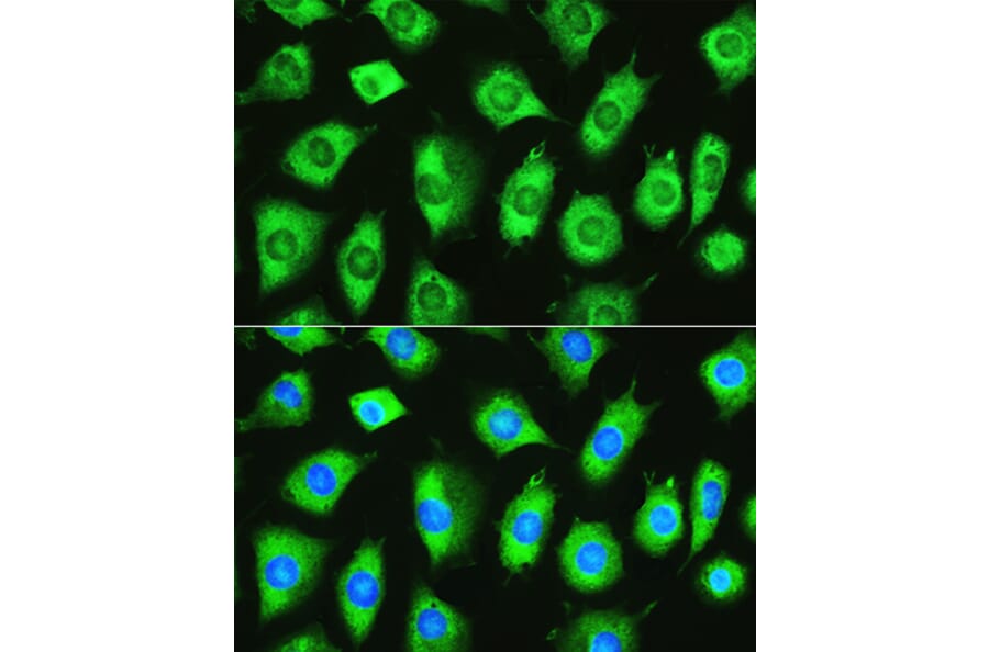 Immunofluorescence - Anti-YTHDF1 Antibody (A90730) - Antibodies.com