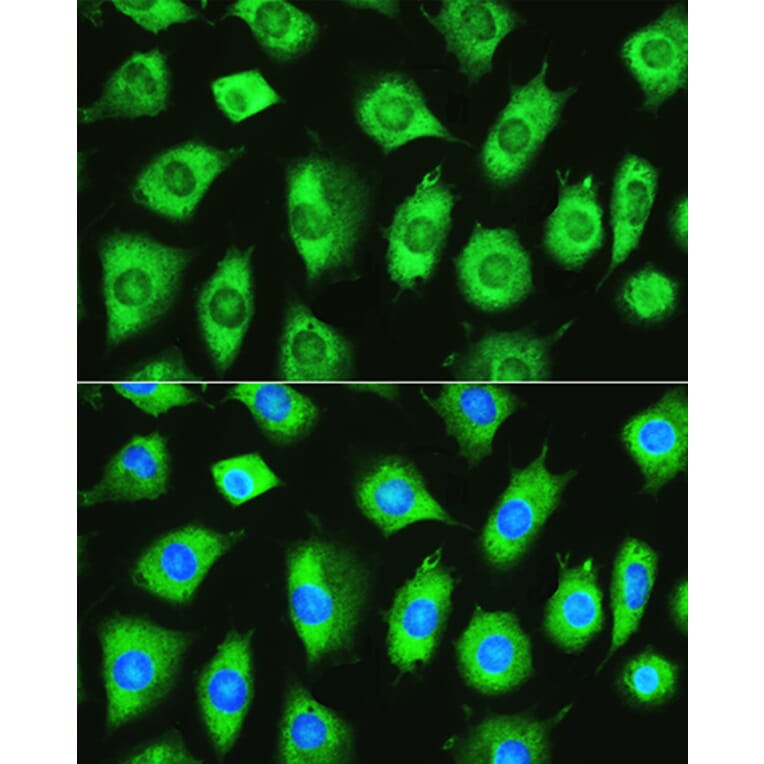 Immunofluorescence - Anti-YTHDF1 Antibody (A90730) - Antibodies.com