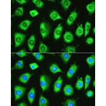 Immunofluorescence - Anti-YTHDF1 Antibody (A90730) - Antibodies.com
