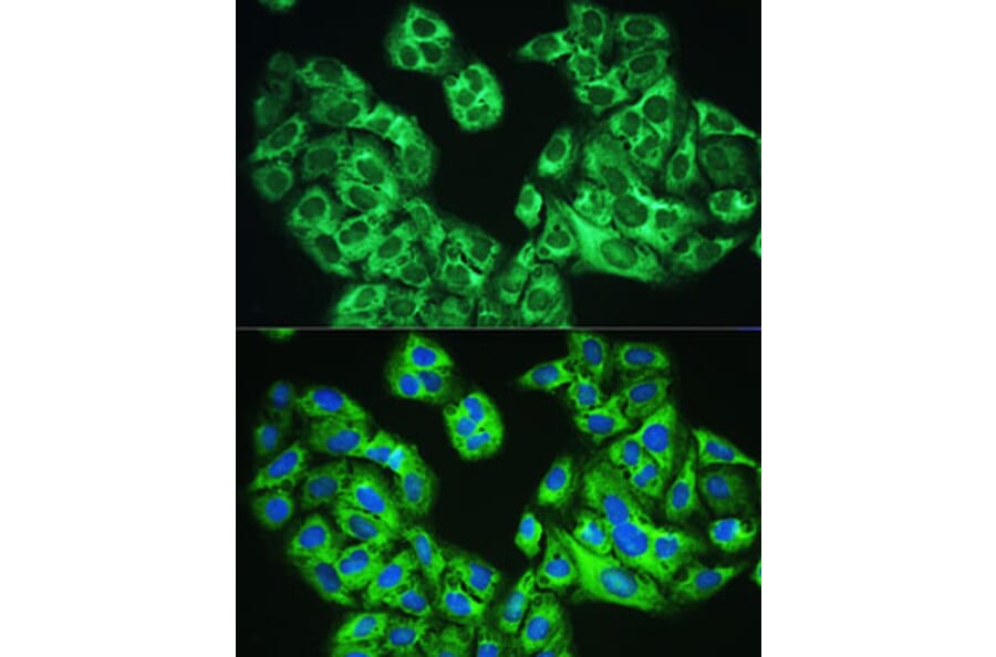 Immunofluorescence - Anti-YTHDF1 Antibody (A90730) - Antibodies.com