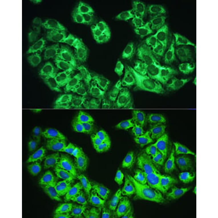 Immunofluorescence - Anti-YTHDF1 Antibody (A90730) - Antibodies.com