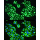 Immunofluorescence - Anti-YTHDF1 Antibody (A90730) - Antibodies.com