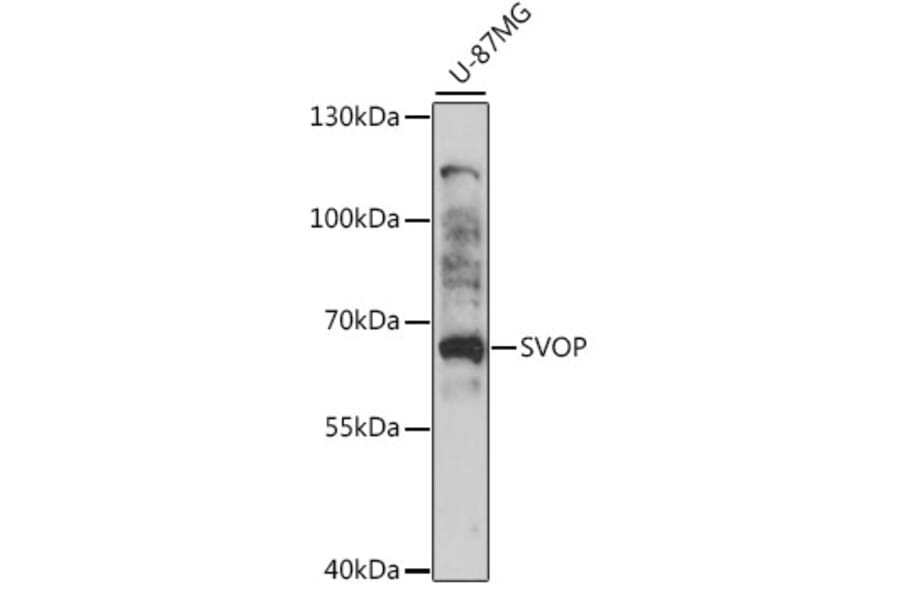 Western Blot - Anti-SVOP Antibody (A90732) - Antibodies.com