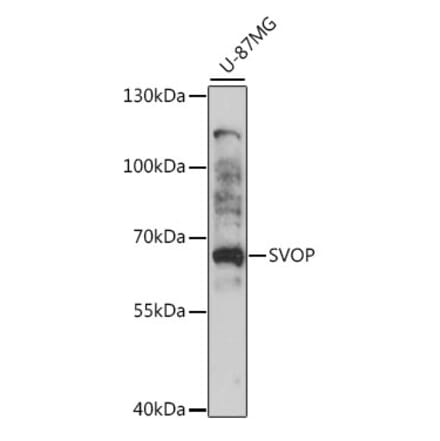 Western Blot - Anti-SVOP Antibody (A90732) - Antibodies.com