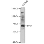 Western Blot - Anti-SVOP Antibody (A90732) - Antibodies.com