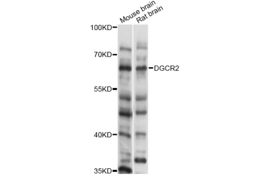 Western Blot - Anti-DGCR2 Antibody (A14267) - Antibodies.com