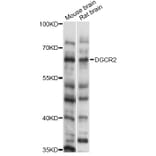 Western Blot - Anti-DGCR2 Antibody (A14267) - Antibodies.com