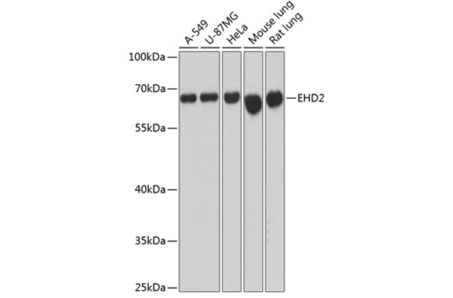 Western Blot - Anti-EHD2 Antibody (A90734) - Antibodies.com