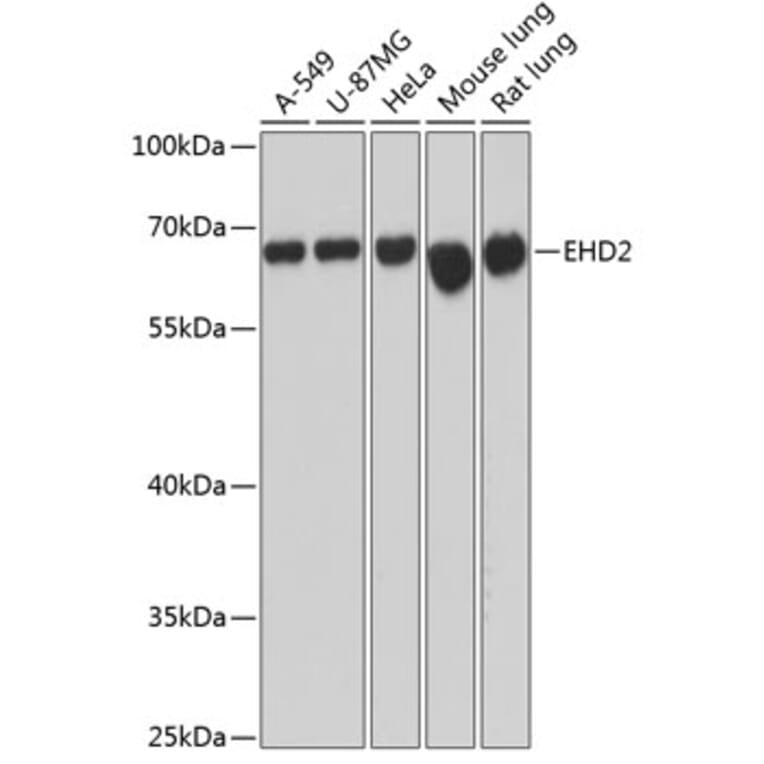 Western Blot - Anti-EHD2 Antibody (A90734) - Antibodies.com