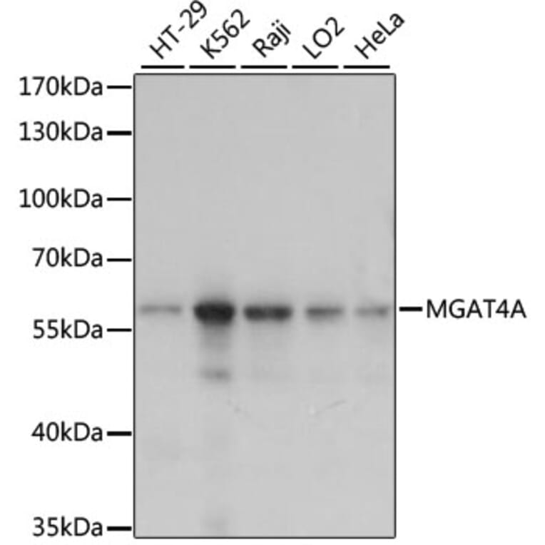 Western Blot - Anti-MGT4A Antibody (A90735) - Antibodies.com