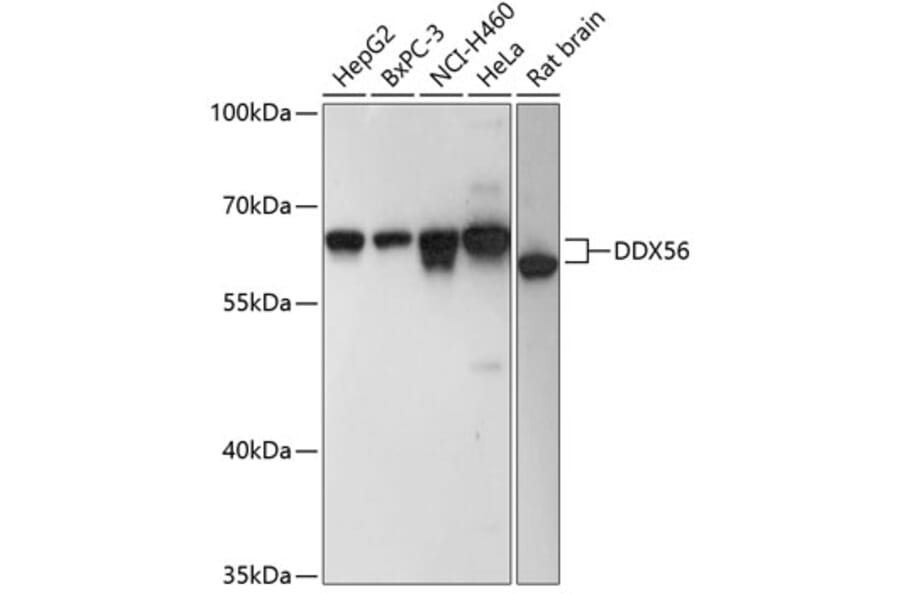 Western Blot - Anti-DDX56 Antibody (A90736) - Antibodies.com