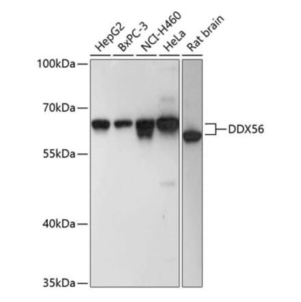 Western Blot - Anti-DDX56 Antibody (A90736) - Antibodies.com