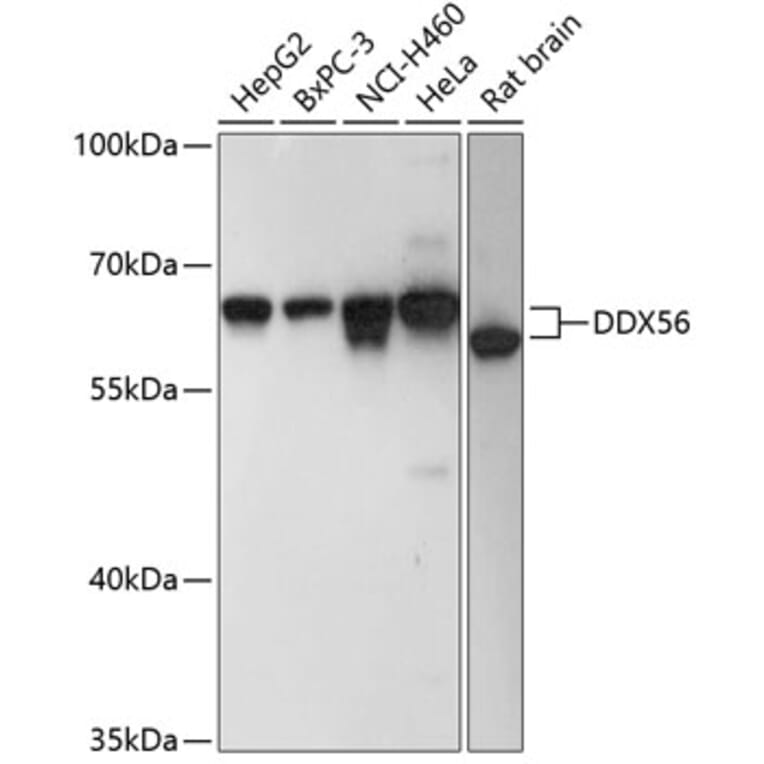 Western Blot - Anti-DDX56 Antibody (A90736) - Antibodies.com