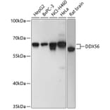 Western Blot - Anti-DDX56 Antibody (A90736) - Antibodies.com
