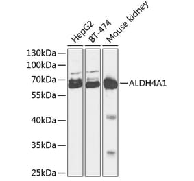 Western Blot - Anti-ALDH4A1 Antibody (A90737) - Antibodies.com