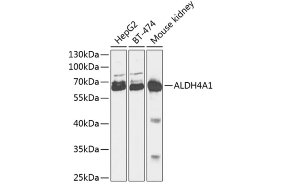 Western Blot - Anti-ALDH4A1 Antibody (A90737) - Antibodies.com