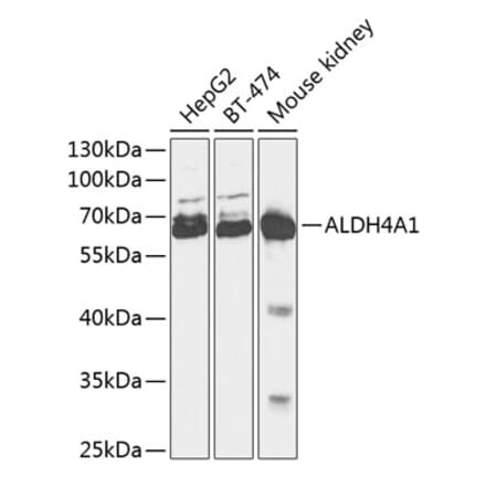 Western Blot - Anti-ALDH4A1 Antibody (A90737) - Antibodies.com