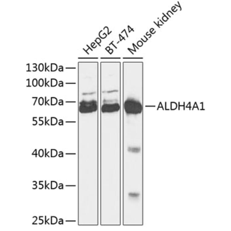 Western Blot - Anti-ALDH4A1 Antibody (A90737) - Antibodies.com