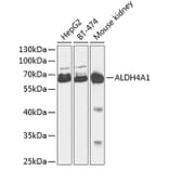 Western Blot - Anti-ALDH4A1 Antibody (A90737) - Antibodies.com