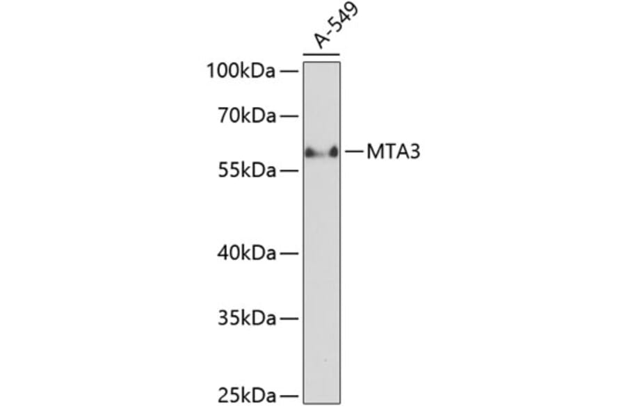 Western Blot - Anti-MTA3 Antibody (A90738) - Antibodies.com