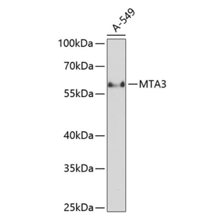 Western Blot - Anti-MTA3 Antibody (A90738) - Antibodies.com