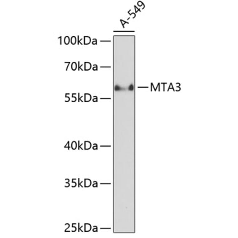 Western Blot - Anti-MTA3 Antibody (A90738) - Antibodies.com