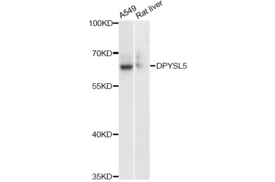 Western Blot - Anti-DPYSL5 Antibody (A13892) - Antibodies.com