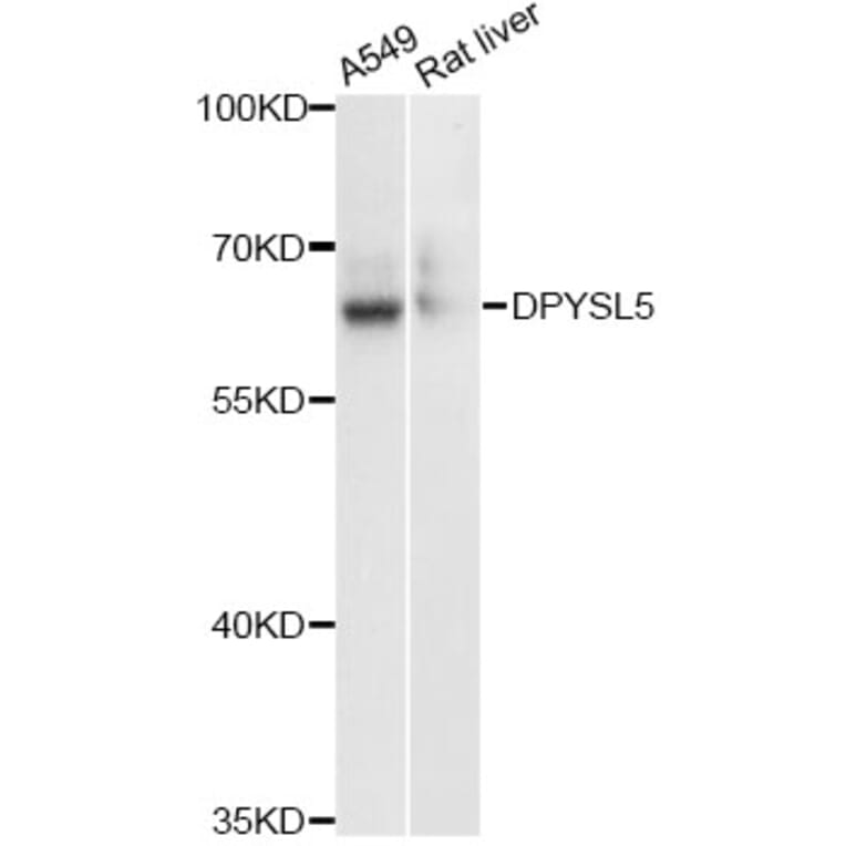 Western Blot - Anti-DPYSL5 Antibody (A13892) - Antibodies.com
