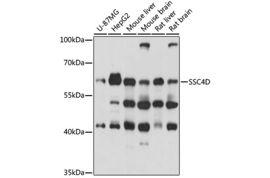 Western Blot - Anti-SSC4D Antibody (A90740) - Antibodies.com
