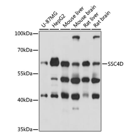Western Blot - Anti-SSC4D Antibody (A90740) - Antibodies.com