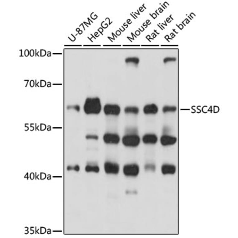 Western Blot - Anti-SSC4D Antibody (A90740) - Antibodies.com