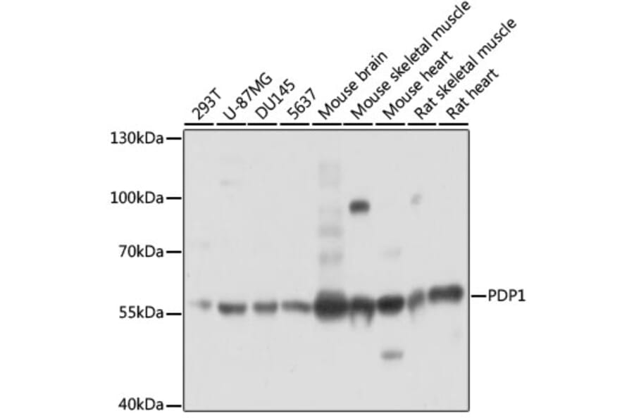 Western Blot - Anti-PDP1/PDP Antibody (A90741) - Antibodies.com