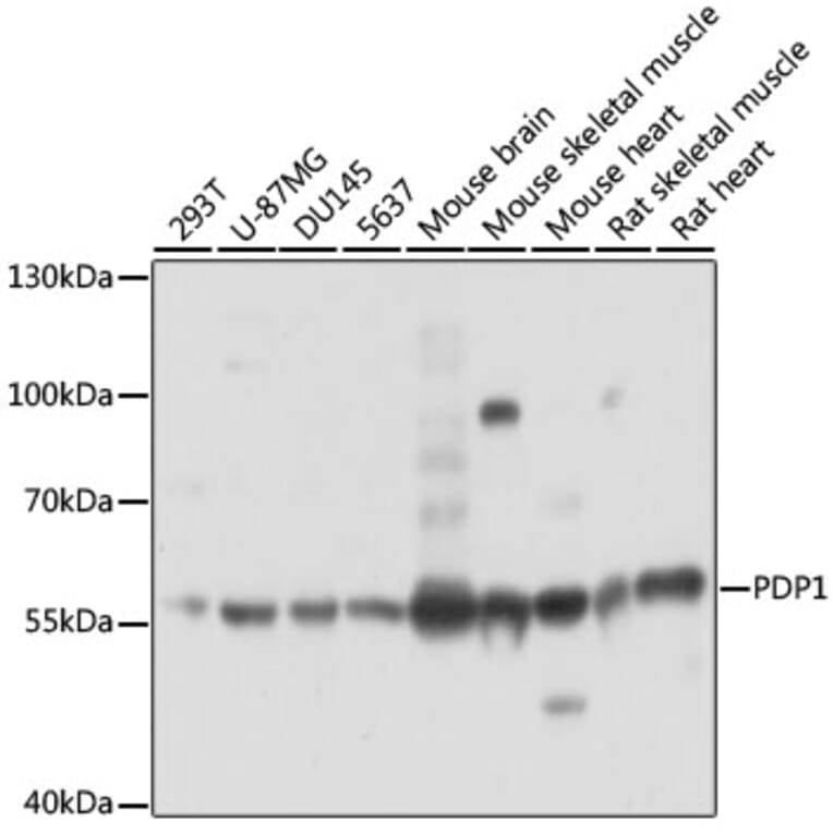 Western Blot - Anti-PDP1/PDP Antibody (A90741) - Antibodies.com