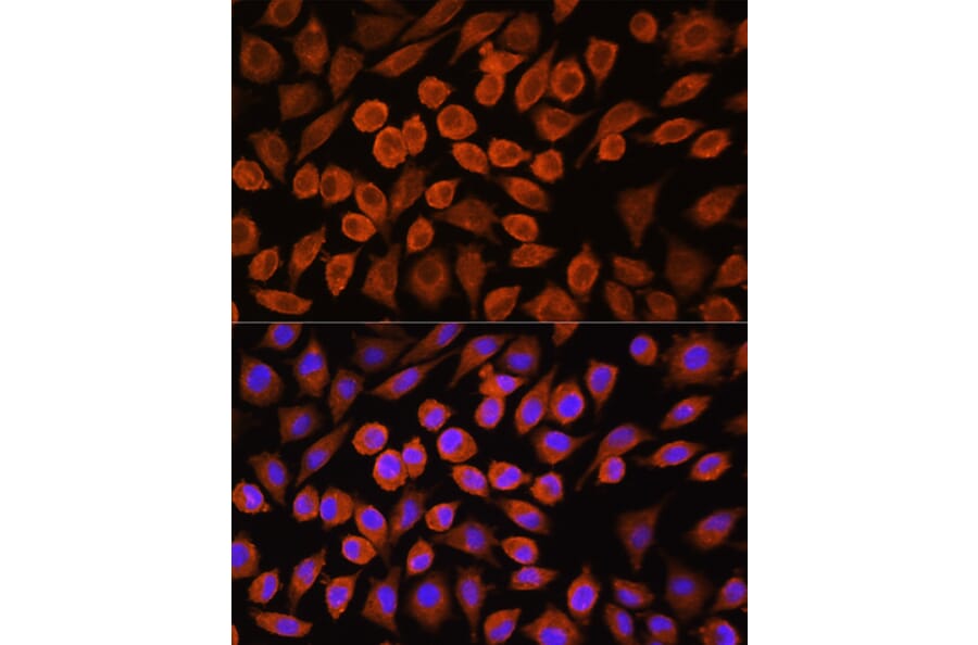 Immunofluorescence - Anti-PDP1/PDP Antibody (A90741) - Antibodies.com