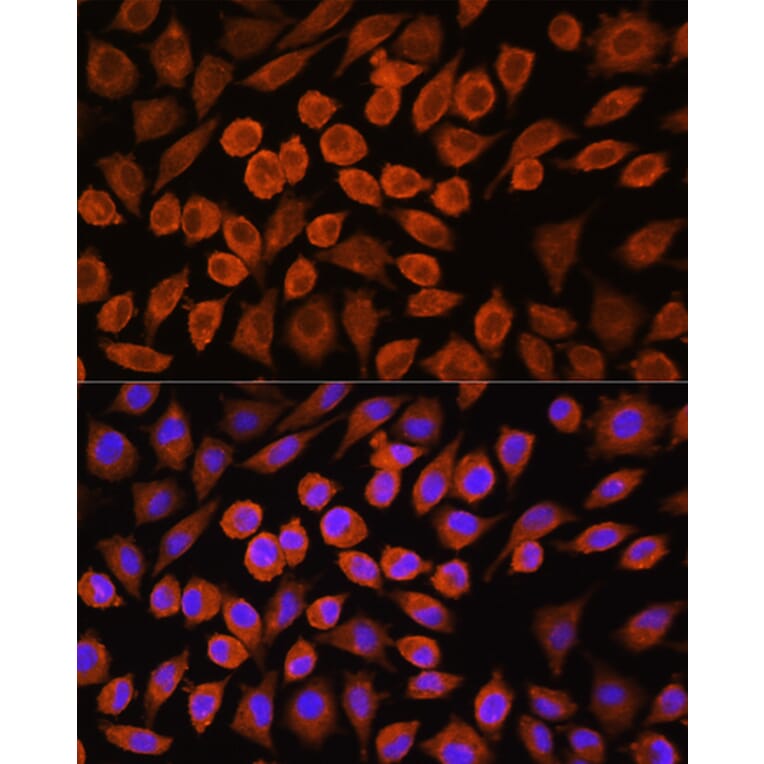 Immunofluorescence - Anti-PDP1/PDP Antibody (A90741) - Antibodies.com