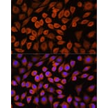 Immunofluorescence - Anti-PDP1/PDP Antibody (A90741) - Antibodies.com