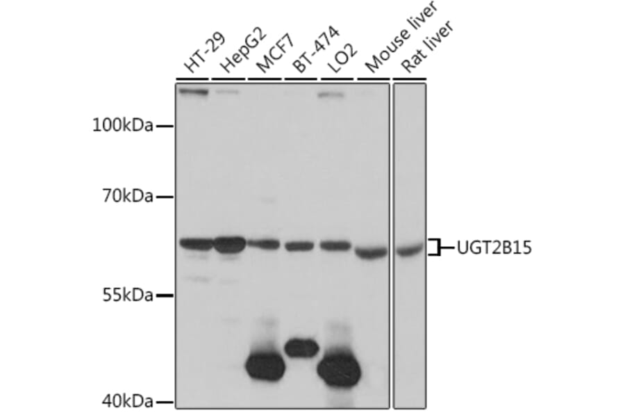 Western Blot - Anti-UGT2B15 Antibody (A90742) - Antibodies.com