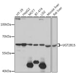 Western Blot - Anti-UGT2B15 Antibody (A90742) - Antibodies.com