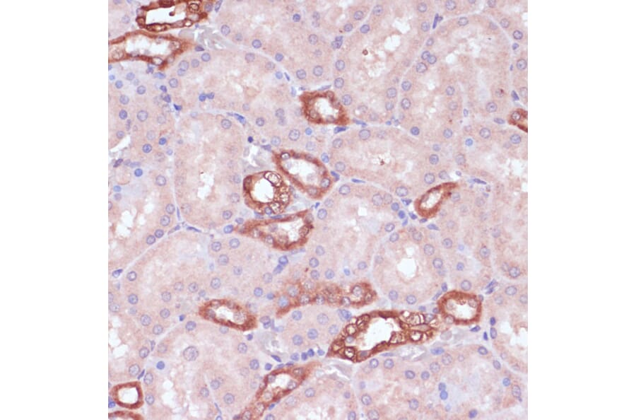 Immunohistochemistry - Anti-UGT2B15 Antibody (A90742) - Antibodies.com