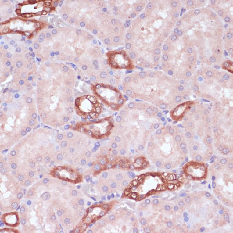 Immunohistochemistry - Anti-UGT2B15 Antibody (A90742) - Antibodies.com