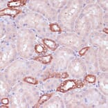 Immunohistochemistry - Anti-UGT2B15 Antibody (A90742) - Antibodies.com