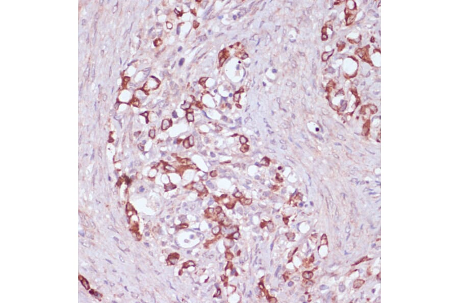 Immunohistochemistry - Anti-UGT2B15 Antibody (A90742) - Antibodies.com