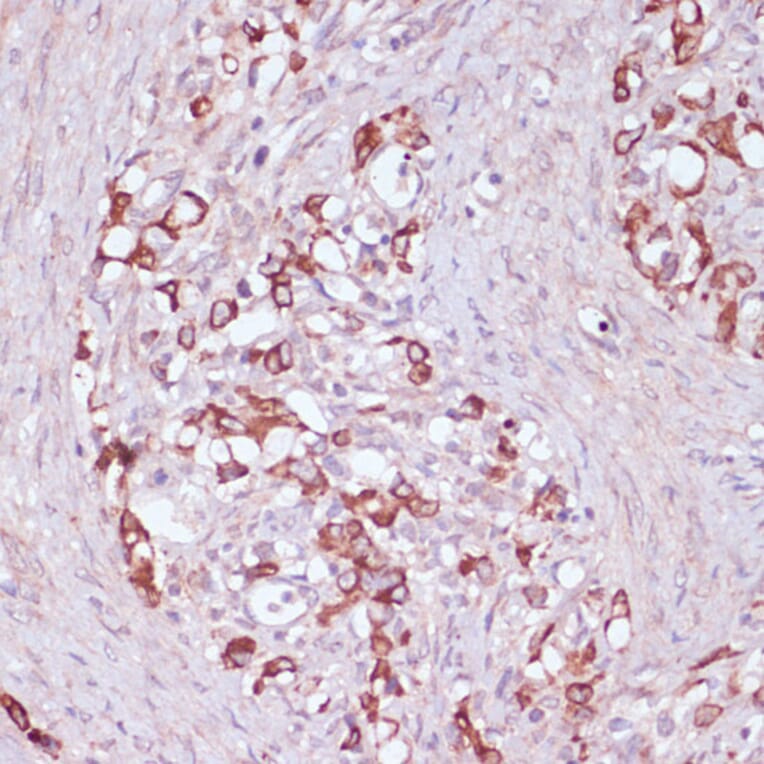 Immunohistochemistry - Anti-UGT2B15 Antibody (A90742) - Antibodies.com