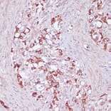 Immunohistochemistry - Anti-UGT2B15 Antibody (A90742) - Antibodies.com