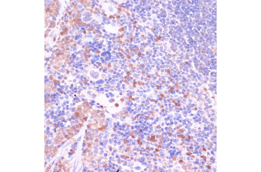 Immunohistochemistry - Anti-UGT2B15 Antibody (A90742) - Antibodies.com