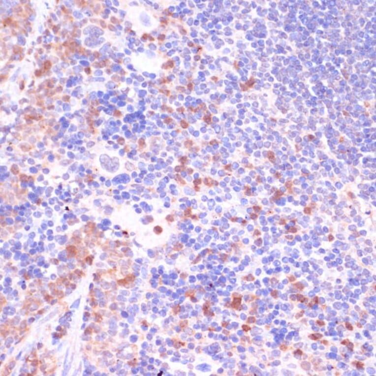 Immunohistochemistry - Anti-UGT2B15 Antibody (A90742) - Antibodies.com