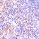 Immunohistochemistry - Anti-UGT2B15 Antibody (A90742) - Antibodies.com